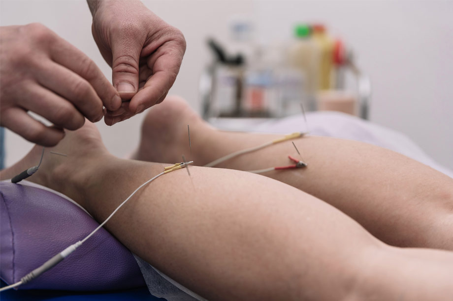 Ηλεκτροβελονισμός στα κάτω άκρα για ανακούφιση από μυοσκελετικούς πόνους